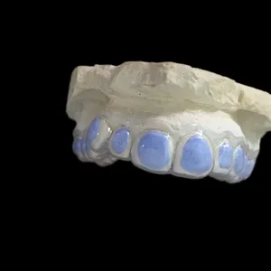 Bleaching tray – case by Well Dental Lab