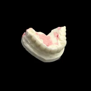 Emax veneer – case by Well Dental Lab (6)