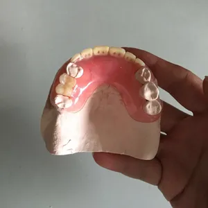 Flexible denture – case by Well Dental Lab (2)