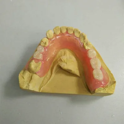 Flexible denture – case by Well Dental Lab
