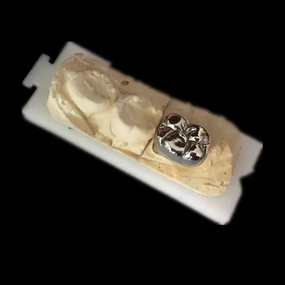 FMC – case by Well Dental Lab