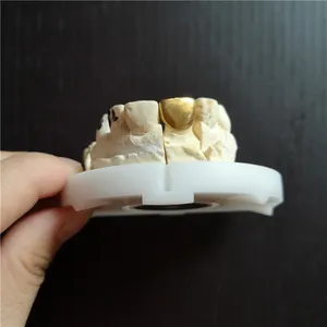Full gold crown – case by Well Dental Lab