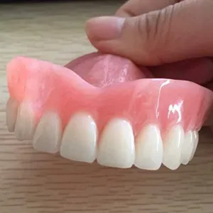 Full upper denture – case by Well Dental Lab (2)