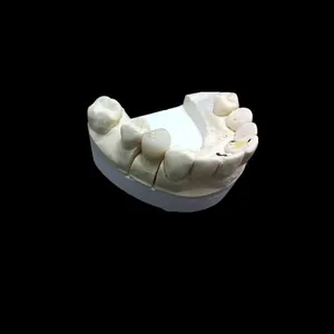 Zirconia crown – case by Well Dental Lab (2)