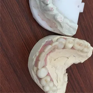 Implant bridge – case by Well Dental Lab