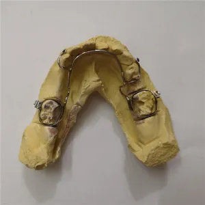 Lower lingual arch – case by Well Dental Lab