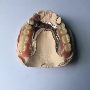Metal framework – case by Well Dental Lab (2)
