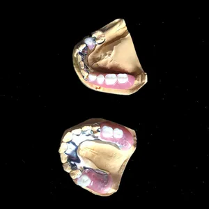 Cast partial – case by Well Dental Lab (2)