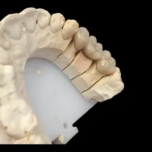 Pfm – case by Well Dental Lab (2)