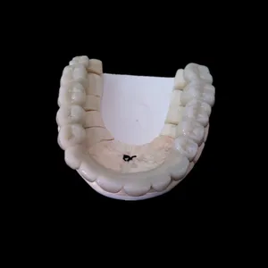 PFM bridge – case by Well Dental Lab