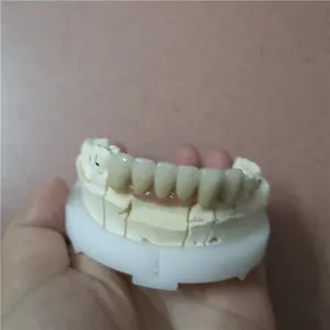 Pfm with pink gingival – case by Well Dental Lab