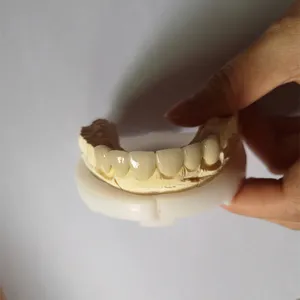 PFM bridge – case by Well Dental Lab (2)