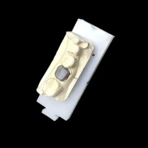 Post core – case by Well Dental Lab