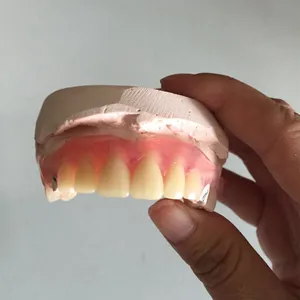Valplast – case by Well Dental Lab