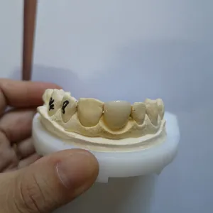 Veneer – case by Well Dental Lab (4)