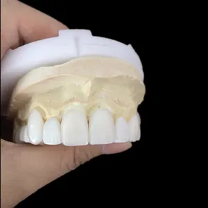 Zirconia crown – case by Well Dental Lab